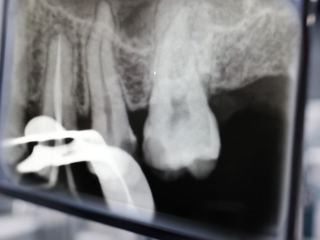 endodontie2 endodontie2