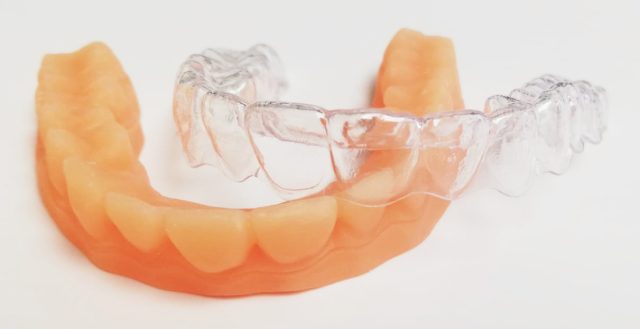 Occlusodontie Occlusodontie