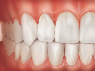 Parodonte Sain Parodonte Sain